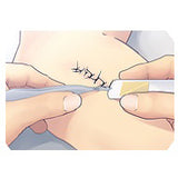 SutureOut - Suture Removal Kit