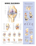 Chart Knee Injuries