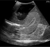 Female Ultrasound Training Pelvis ,EA