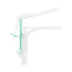 Alliance™ Disposable Vaginal Specula             Disposable Vaginal Specula with Light