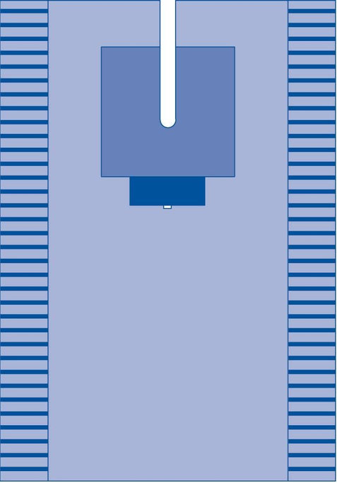 EENT Split Drape; 78" x 121" (198 cm x 307 cm) — Case of 8