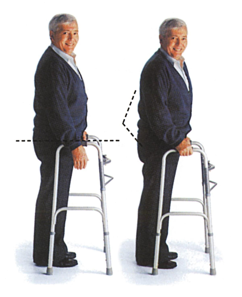 Adult 2-Button Folding Walker without Wheels; Basic — Case of 4