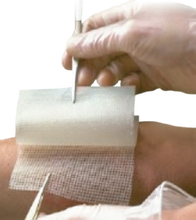 Genuine supplier photograph of Bactigras wound dressing family; supplied dimensions and pack stated in listing.
