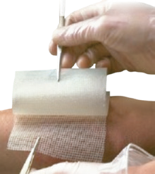 Genuine supplier photograph of Bactigras wound dressing family; supplied dimensions and pack stated in listing.